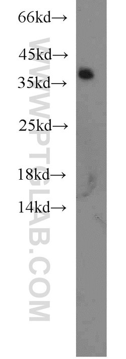 hnRNP-E1 Rabbit anti-Human, Mouse, Rat, Polyclonal, Proteintech 150 &mu;L;