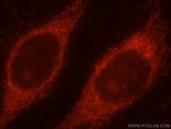 TOM70 Rabbit anti-Human, Mouse, Rat, Polyclonal, Proteintech 150 &mu;L;