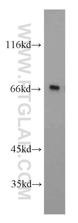 TOM70 Rabbit anti-Human, Mouse, Rat, Polyclonal, Proteintech:  