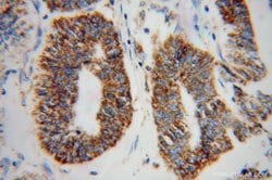 GSTK1 Rabbit anti-Human, Mouse, Rat, Polyclonal, Proteintech:Antibodies:Primary