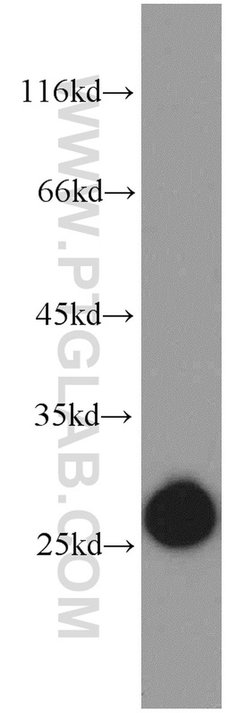 GSTK1 Rabbit anti-Human, Mouse, Rat, Polyclonal, Proteintech:Antibodies:Primary