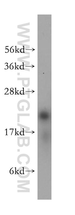 RPL12 Rabbit anti-Human, Mouse, Rat, Polyclonal, Proteintech:Antibodies:Primary