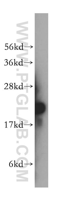 RPL12 Rabbit anti-Human, Mouse, Rat, Polyclonal, Proteintech:Antibodies:Primary