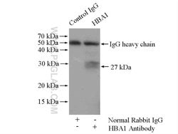 Hemoglobin alpha Rabbit anti-Human, Mouse, Rat, Polyclonal, Proteintech:Antibodies:Primary