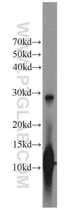 Hemoglobin alpha Rabbit anti-Human, Mouse, Rat, Polyclonal, Proteintech:Antibodies:Primary