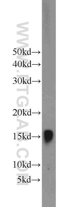 Hemoglobin alpha Rabbit anti-Human, Mouse, Rat, Polyclonal, Proteintech:Antibodies:Primary