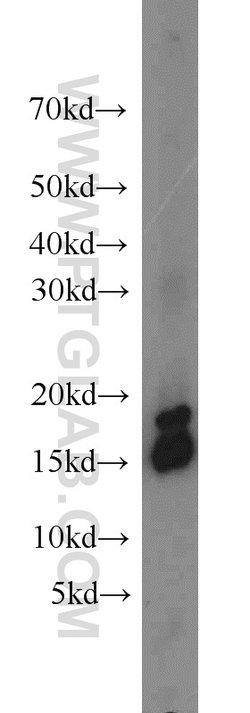 Hemoglobin alpha Rabbit anti-Human, Mouse, Rat, Polyclonal, Proteintech:Antibodies:Primary