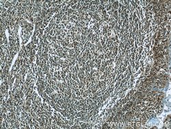 LMP2 Rabbit anti-Human, Mouse, Rat, Polyclonal, Proteintech:Antibodies:Primary