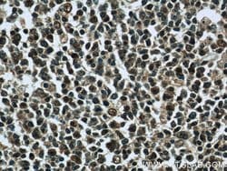 LMP2 Rabbit anti-Human, Mouse, Rat, Polyclonal, Proteintech:Antibodies:Primary