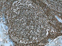 LMP2 Rabbit anti-Human, Mouse, Rat, Polyclonal, Proteintech:Antibodies:Primary