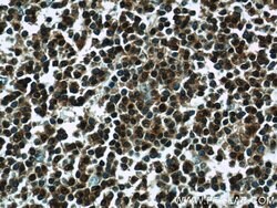 LMP2 Rabbit anti-Human, Mouse, Rat, Polyclonal, Proteintech:Antibodies:Primary