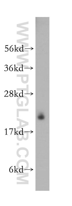 LMP2 Rabbit anti-Human, Mouse, Rat, Polyclonal, Proteintech:Antibodies:Primary