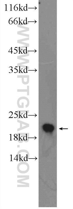 LMP2 Rabbit anti-Human, Mouse, Rat, Polyclonal, Proteintech:Antibodies:Primary