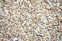 LMP2 Rabbit anti-Human, Mouse, Rat, Polyclonal, Proteintech:Antibodies:Primary