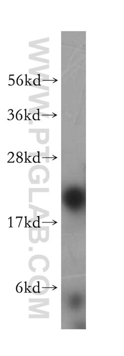LMP2 Rabbit anti-Human, Mouse, Rat, Polyclonal, Proteintech:Antibodies:Primary
