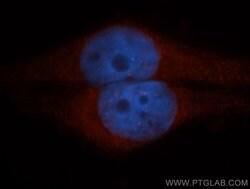 CLIC1 Rabbit anti-Human, Mouse, Rat, Polyclonal, Proteintech:Antibodies:Primary