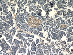 CLIC1 Rabbit anti-Human, Mouse, Rat, Polyclonal, Proteintech:Antibodies:Primary