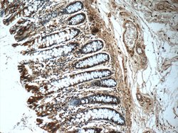 CLIC1 Rabbit anti-Human, Mouse, Rat, Polyclonal, Proteintech:Antibodies:Primary