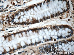 CLIC1 Rabbit anti-Human, Mouse, Rat, Polyclonal, Proteintech:Antibodies:Primary