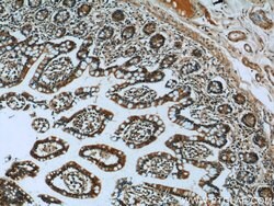 CLIC1 Rabbit anti-Human, Mouse, Rat, Polyclonal, Proteintech:Antibodies:Primary