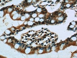 CLIC1 Rabbit anti-Human, Mouse, Rat, Polyclonal, Proteintech:Antibodies:Primary