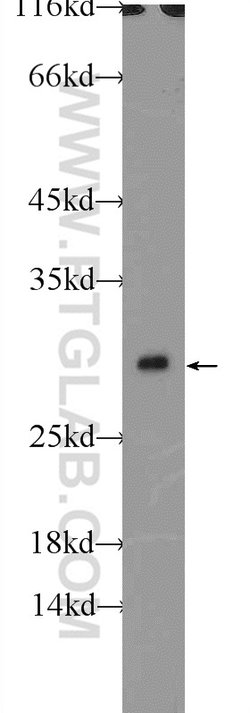 CLIC1 Rabbit anti-Human, Mouse, Rat, Polyclonal, Proteintech:Antibodies:Primary