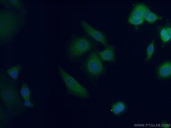 AFP Rabbit anti-Human, Mouse, Rat, Polyclonal, Proteintech:Antibodies:Primary