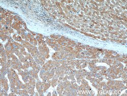 AFP Rabbit anti-Human, Mouse, Rat, Polyclonal, Proteintech:Antibodies:Primary