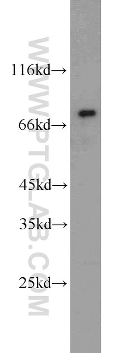 AFP Rabbit anti-Human, Mouse, Rat, Polyclonal, Proteintech:Antibodies:Primary