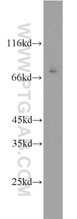 AFP Rabbit anti-Human, Mouse, Rat, Polyclonal, Proteintech:Antibodies:Primary