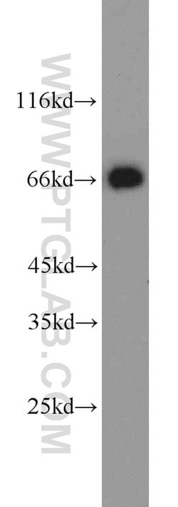 AFP Rabbit anti-Human, Mouse, Rat, Polyclonal, Proteintech:Antibodies:Primary