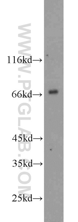 AFP Rabbit anti-Human, Mouse, Rat, Polyclonal, Proteintech:Antibodies:Primary