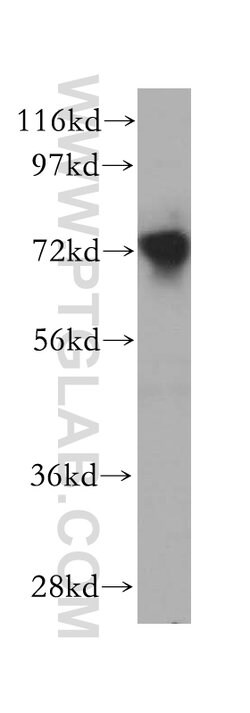 AFP Rabbit anti-Human, Mouse, Rat, Polyclonal, Proteintech:Antibodies:Primary