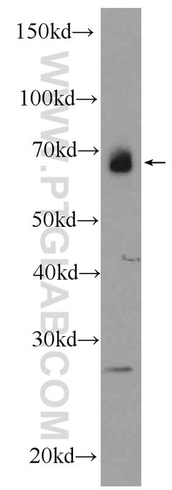 AFP Rabbit anti-Human, Mouse, Rat, Polyclonal, Proteintech:Antibodies:Primary