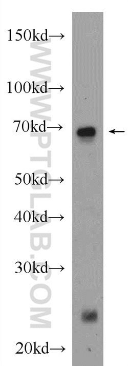 AFP Rabbit anti-Human, Mouse, Rat, Polyclonal, Proteintech:Antibodies:Primary