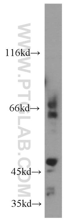 MT1-MMP Rabbit anti-Human, Mouse, Rat, Zebrafish, Polyclonal, Proteintech:Antibodies:Primary