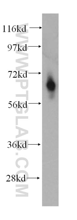 MT1-MMP Rabbit anti-Human, Mouse, Rat, Zebrafish, Polyclonal, Proteintech:Antibodies:Primary
