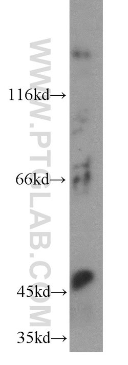 MT1-MMP Rabbit anti-Human, Mouse, Rat, Zebrafish, Polyclonal, Proteintech:Antibodies:Primary
