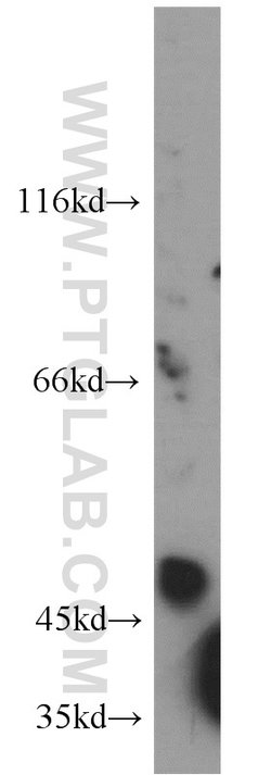 MT1-MMP Rabbit anti-Human, Mouse, Rat, Zebrafish, Polyclonal, Proteintech:Antibodies:Primary