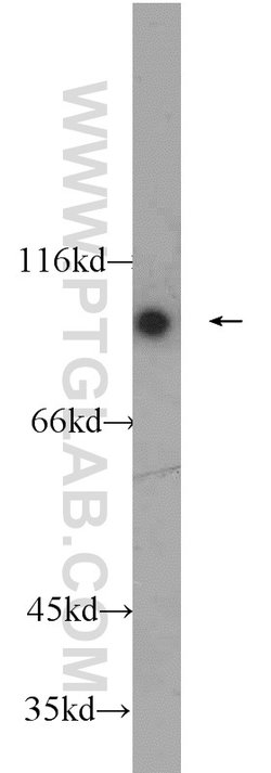 C1S Rabbit anti-Human, Mouse, Rat, Polyclonal, Proteintech 150 &mu;L | Buy Online | Proteintech | Fisher Scientific