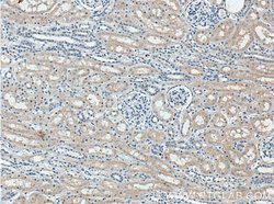 FBXO27 Rabbit anti-Human, Mouse, Rat, Polyclonal, Proteintech 150 &mu;L;