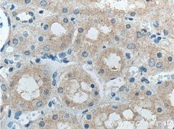 Proteintech Group Inc FBXO27 Rabbit anti-Human, Mouse, Rat, Polyclonal, Proteintech