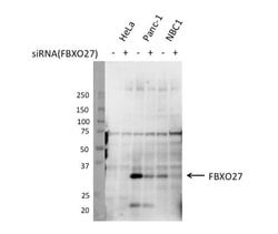 FBXO27 Rabbit anti-Human, Mouse, Rat, Polyclonal, Proteintech 150 &mu;L;