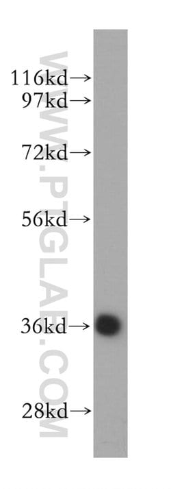 DEDD2 Rabbit anti-Human, Mouse, Rat, Polyclonal, Proteintech 150 &mu;L;