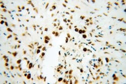 SF3B3 Rabbit anti-Human, Mouse, Rat, Polyclonal, Proteintech 150 &mu;L;