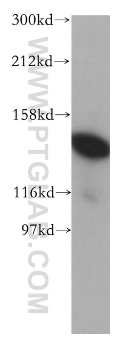 SF3B3 Rabbit anti-Human, Mouse, Rat, Polyclonal, Proteintech 150 &mu;L;