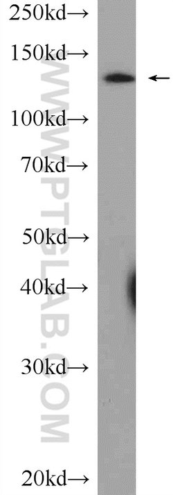 SF3B3 Rabbit anti-Human, Mouse, Rat, Polyclonal, Proteintech 150 &mu;L;