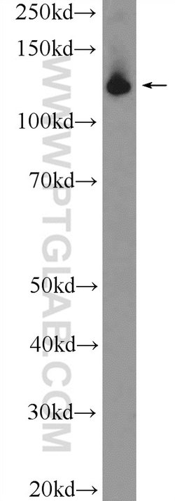 SF3B3 Rabbit anti-Human, Mouse, Rat, Polyclonal, Proteintech 150 &mu;L;