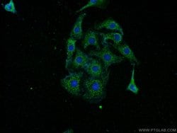 Pikachurin Rabbit anti-Human, Mouse, Rat, Polyclonal, Proteintech 150 &mu;L;