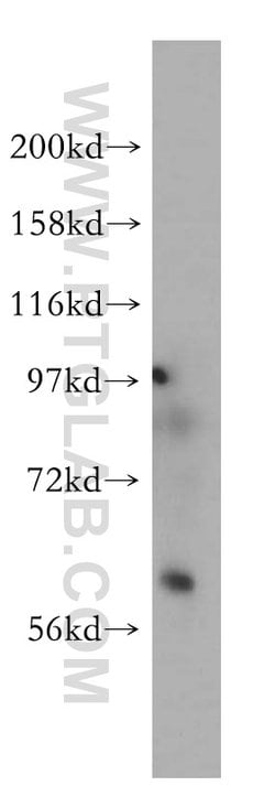 Pikachurin Rabbit anti-Human, Mouse, Rat, Polyclonal, Proteintech 150 &mu;L;